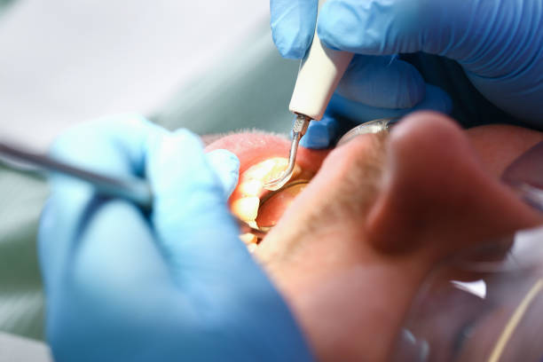Best Broken or Chipped Tooth Repair in De Soto, IA